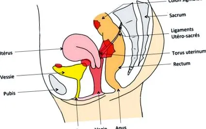 endometrioză