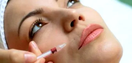 estetică