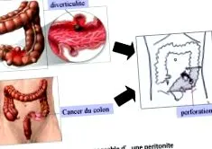 ABCD Chirurgie