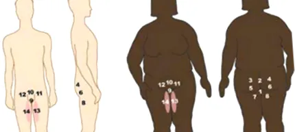 bőrelváltozások