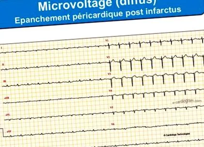 e-kardiogram