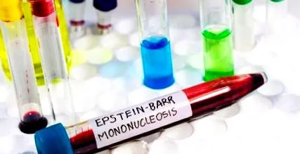 mononucleoză simptome