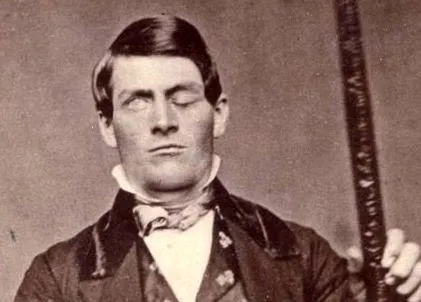 Phineas Gage