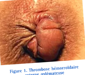proctologia