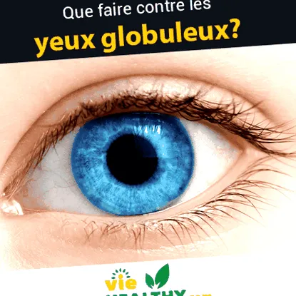megoldások tegyünk