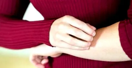 psoriasis