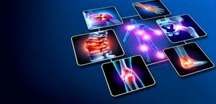 arthritis hogyan