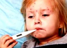 streptoderma