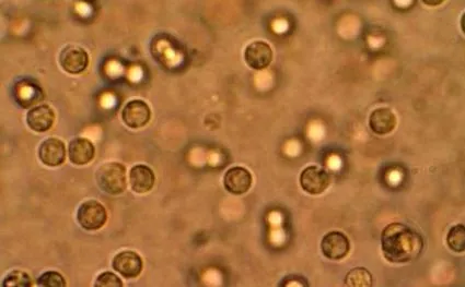 infecțiile