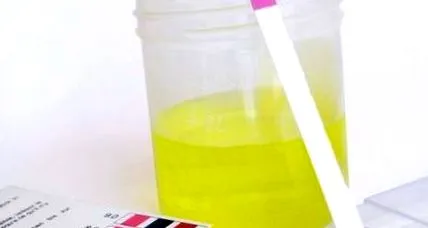 értelmezése