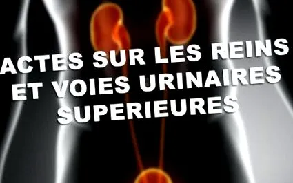 vesékre