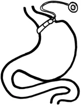 gyomorzenekar gyomorzenekar