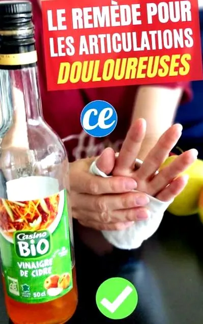 ízületek