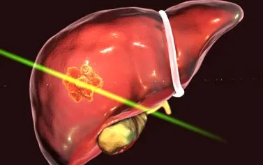 hepatic