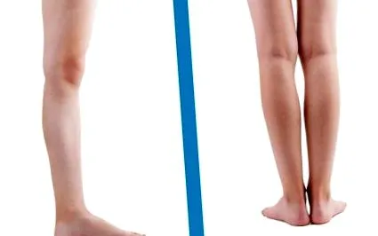 gleznei