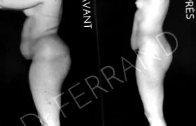ferrand