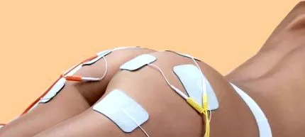 electrostimulare