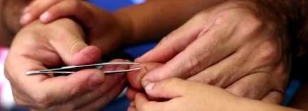 eltávolítani eltávolítani
