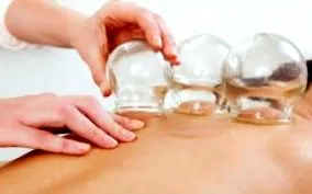 cupping
