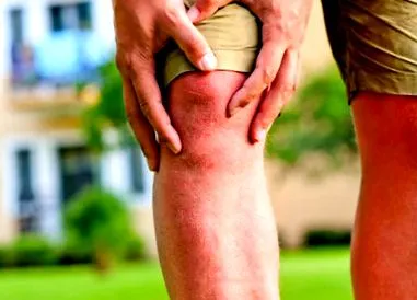 osteoarthritis