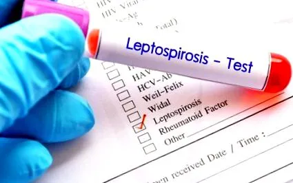 leptospiroză