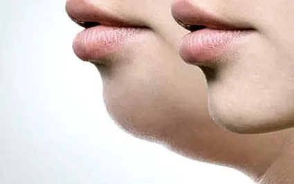 clinique