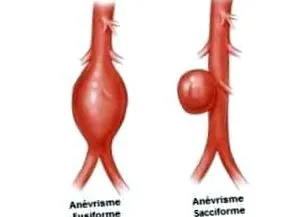 prevenire