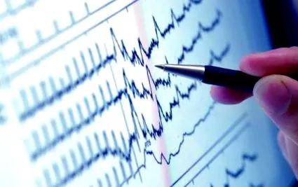 tachycardia
