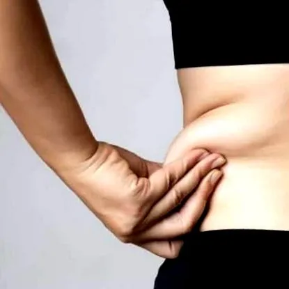 siluetei chirurgie