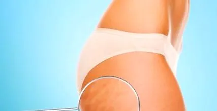cellulit cellulit