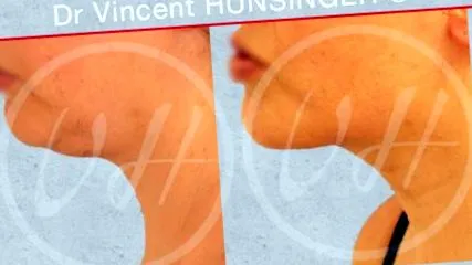 hunsinger