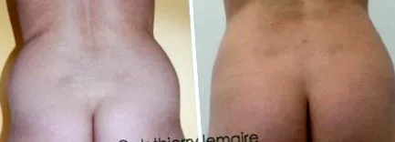 lemaire