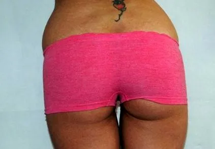 chirurgie