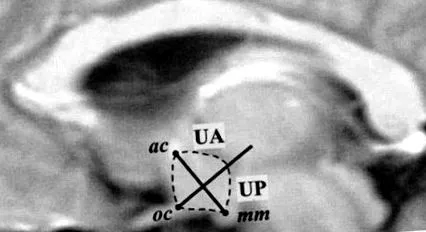 fmri