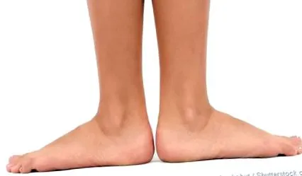 lábam