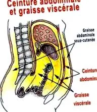 viscerale