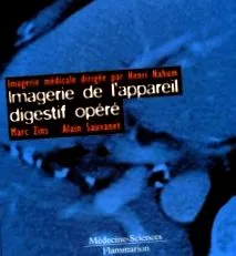 érintett érintett