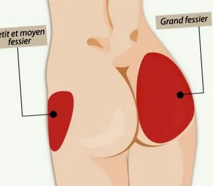 fenék zsírleszívása fenék