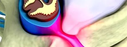dureri dureri