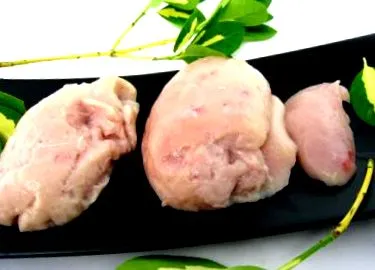 нирки