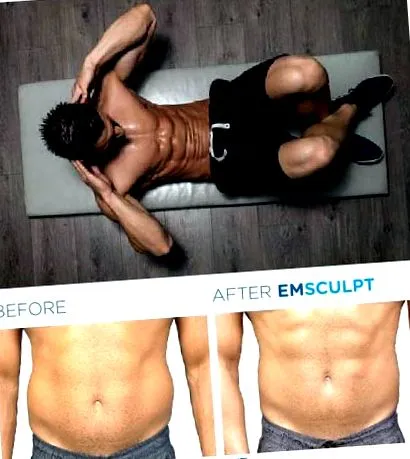 emsculpt