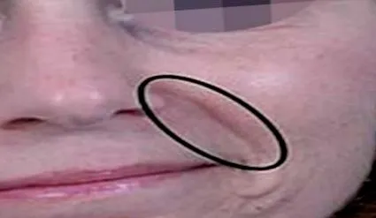redők