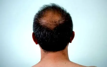 multe