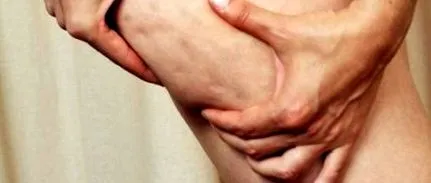 kezelés narancssárga