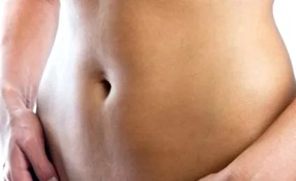 abdominoplastie