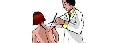 acupunctura