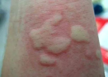 vitalchi
