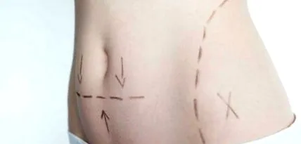 abdomen
