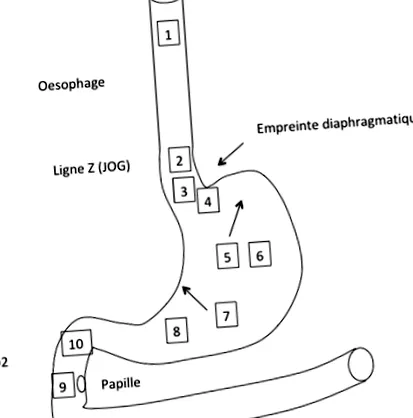 fmc-hge