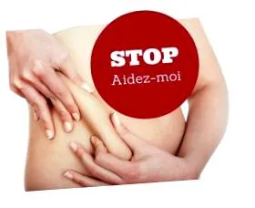 kriolipolízis